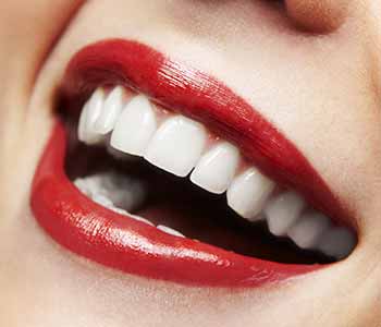 Teeth Whitening Service Offers Two Ways To Brighten Your Smile